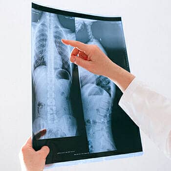 how to remember postural drainage positions